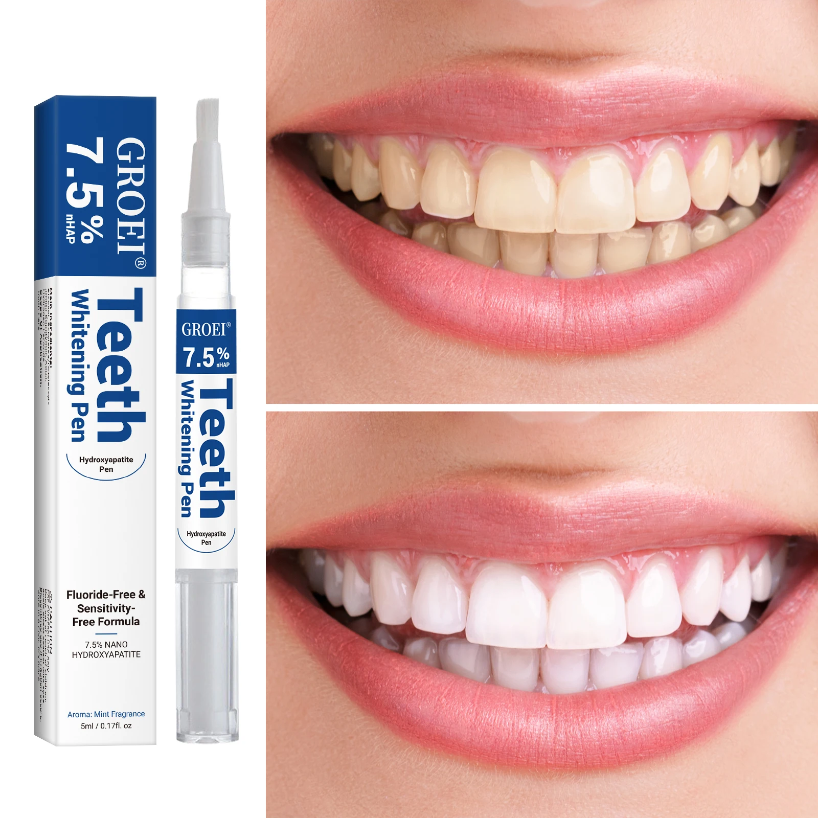 ปากกาฟอกสีฟันไฮดรอกซีอะพาไทต์  - Teeth Whitening Levels บทวิจารณ์และราคา