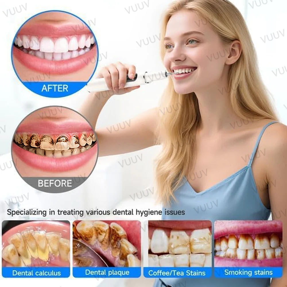 VUUV เครื่องทำความสะอาดฟันอัลต - Teeth Whitening Uv บทวิจารณ์และราคา