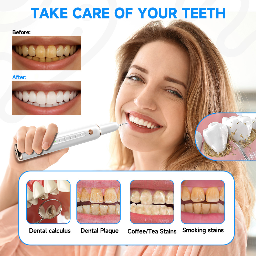 CURVY MOON T4 แปรงสีฟันไฟฟ้าอั - Teeth Whitening Uv บทวิจารณ์และราคา