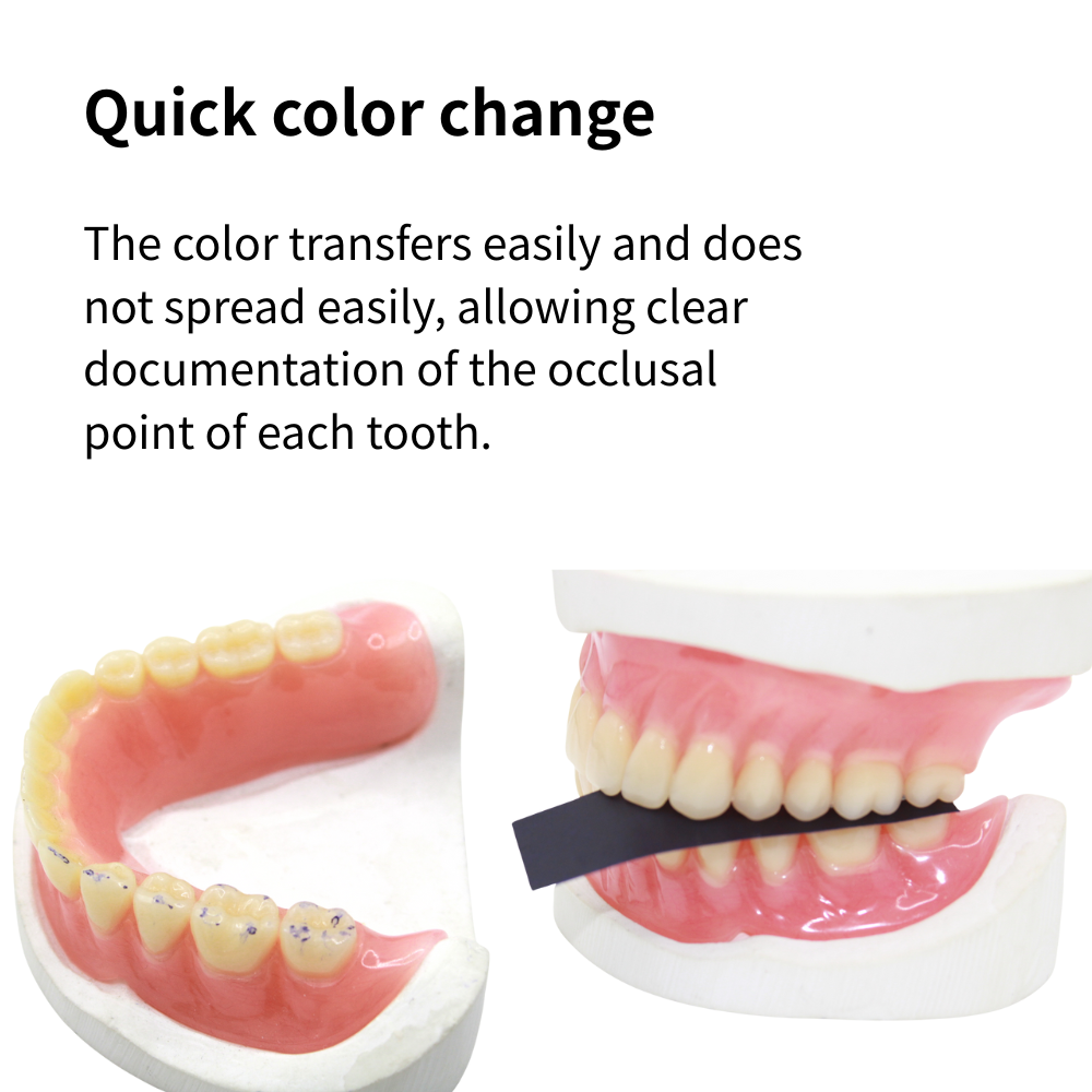 กระดาษขัดฟัน AG 300 แผ่น สีแดง - Teeth Whitening Strips บทวิจารณ์และราคา